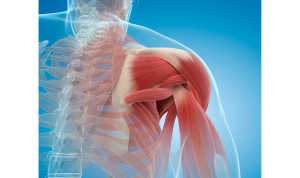 How Long Does it Take to Recover from a Shoulder Muscle Tear?